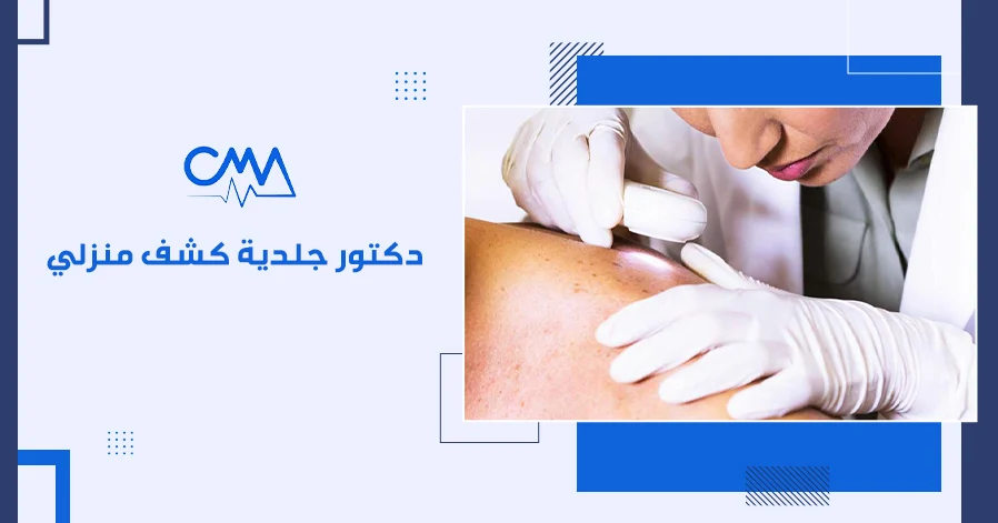 دكتور جلدية كشف منزلي