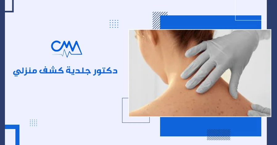 دكتور جلدية كشف منزلي