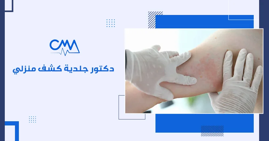 دكتور جلدية كشف منزلي