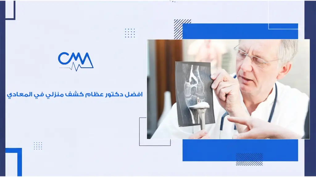 افضل دكتور عظام كشف منزلي في المعادي